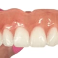 Alternative Payment Options for Dentures: A Comprehensive Guide