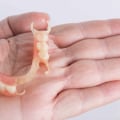 A Comprehensive Look at Flexible Partial Dentures