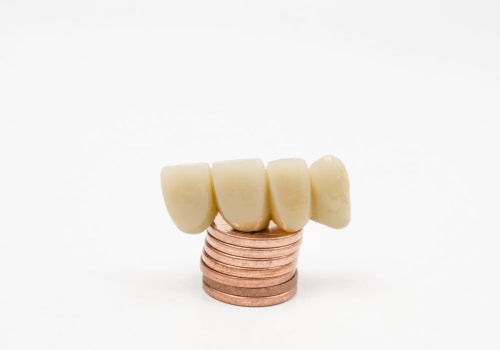 Dental Schools and Clinics: Affordable Options for Dentures